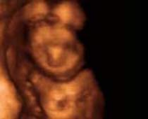 4D Ultrasound 18 weeks old fetus