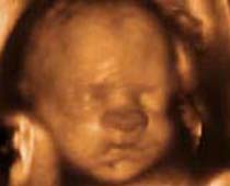 4D Ultrasound Facial Expressions of a fetus 1