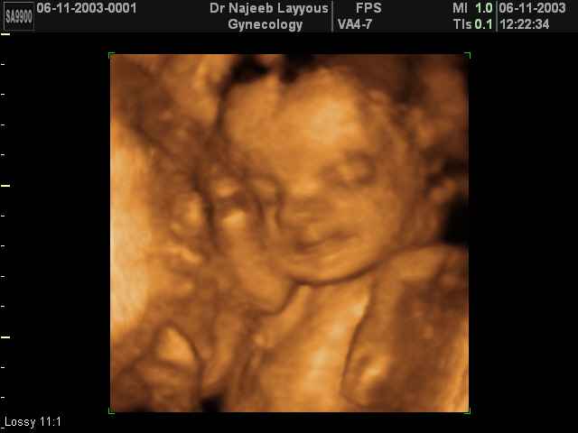 fetus at 7 months pregnancy