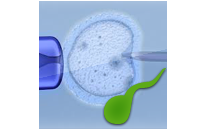Bed Rest After Embryo Transfer Beneficial or Harmful